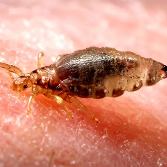 murine typhus test package